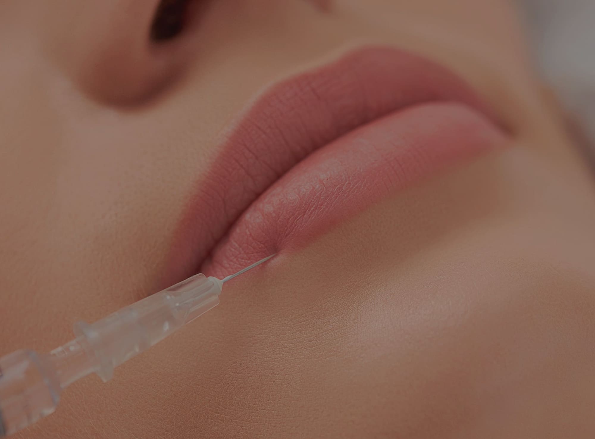 Plastique